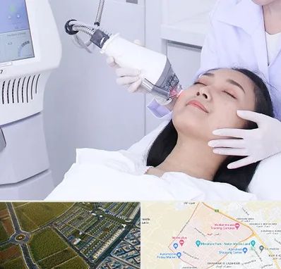 وایتنینگ در الهیه مشهد