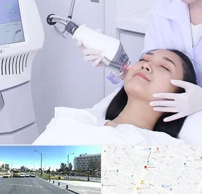 وایتنینگ در بلوار کلاهدوز مشهد