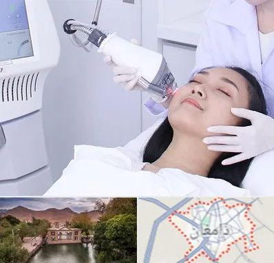 وایتنینگ در دامغان