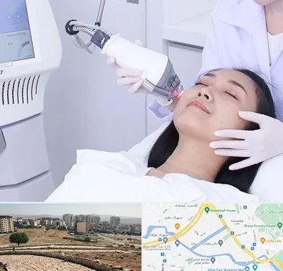 وایتنینگ در کوی وحدت شیراز