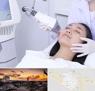 وایتنینگ در قوچان