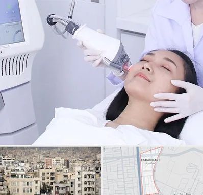 وایتنینگ در اسکندری