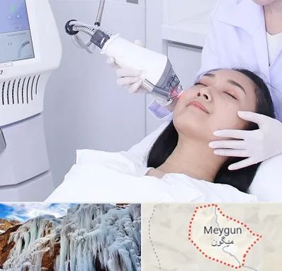 وایتنینگ در میگون