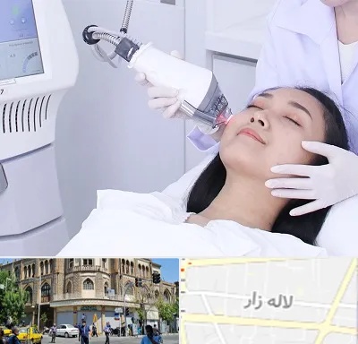 وایتنینگ در لاله زار