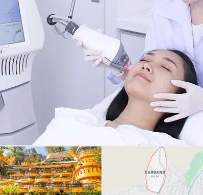 وایتنینگ در دربند