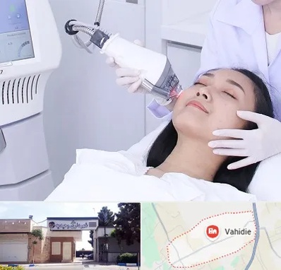 وایتنینگ در وحیدیه شهریار