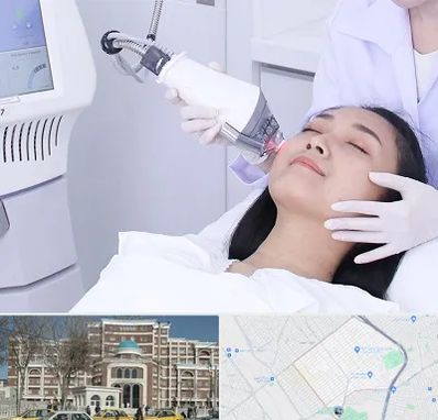 وایتنینگ در طلاب مشهد