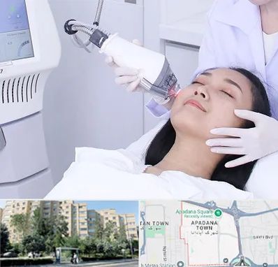 وایتنینگ در آپادانا