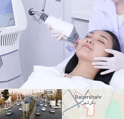 وایتنینگ در باقرشهر
