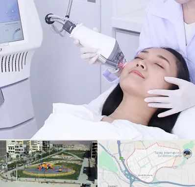 وایتنینگ در مرزداران تبریز