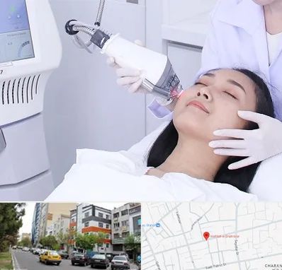 وایتنینگ در هفده شهریور تبریز