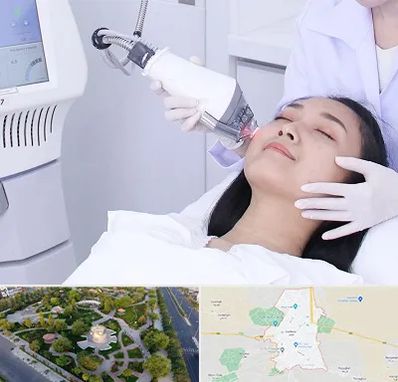 وایتنینگ در کاشمر