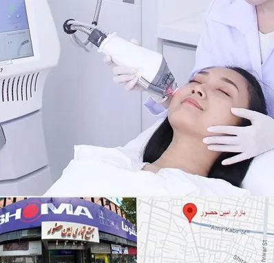 وایتنینگ در امین حضور