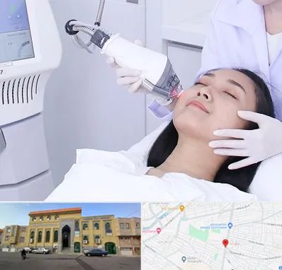 وایتنینگ در زنبیل آباد قم