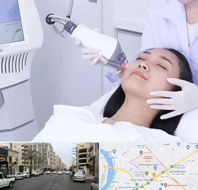 وایتنینگ در زیتون کارمندی اهواز