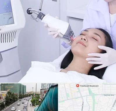 وایتنینگ در بلوار فرحزادی