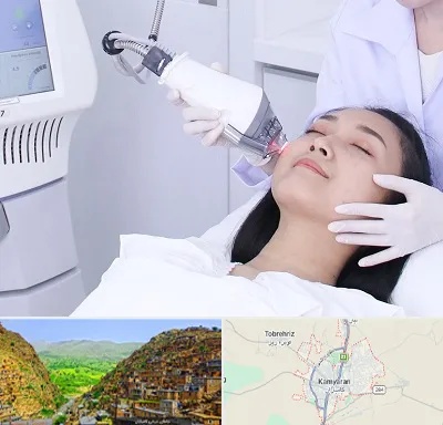 وایتنینگ در کامیاران