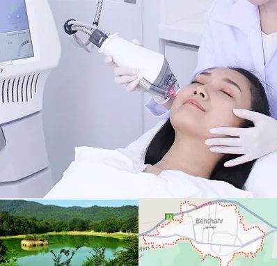 وایتنینگ در بهشهر