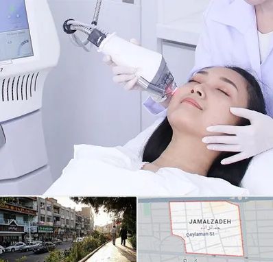وایتنینگ در خیابان جمالزاده