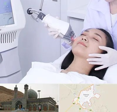 وایتنینگ در شهرضا