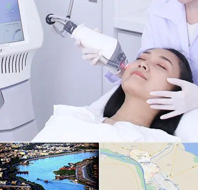 وایتنینگ در خرمشهر
