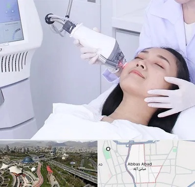 وایتنینگ در عباس آباد تهران