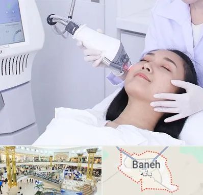 وایتنینگ در بانه