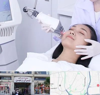 وایتنینگ در ایران زمین