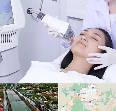 وایتنینگ در مراغه