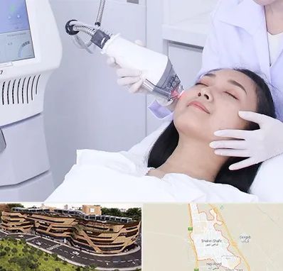 وایتنینگ در شاهین شهر