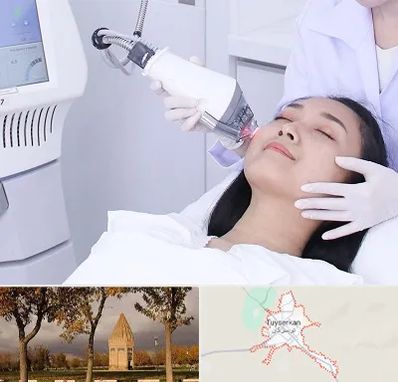 وایتنینگ در تویسرکان