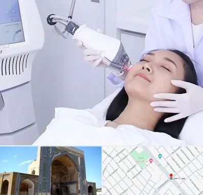 وایتنینگ در مصلی مشهد