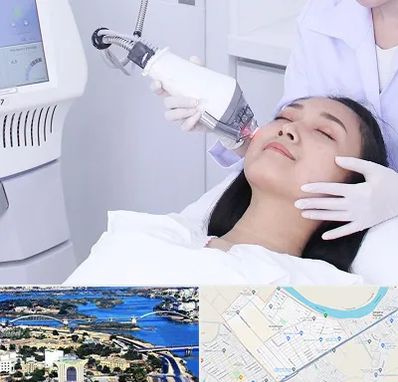 وایتنینگ در کوروش اهواز