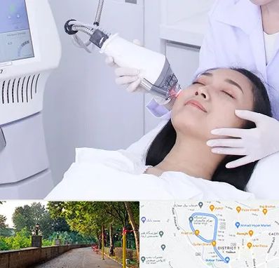 وایتنینگ در بلوار گیلان رشت