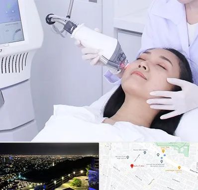 وایتنینگ در هفت تیر مشهد