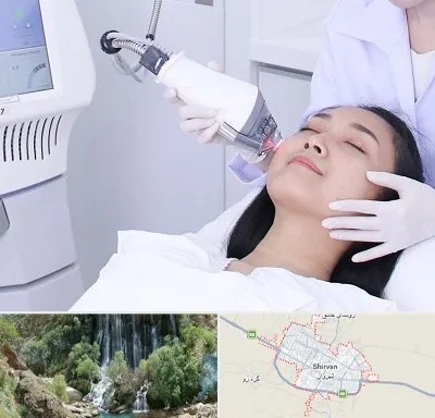 وایتنینگ در شیروان