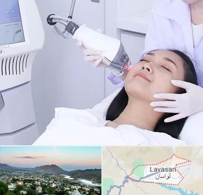 وایتنینگ در لواسان