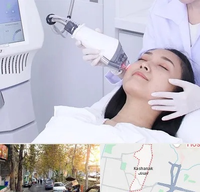 وایتنینگ در کاشانک