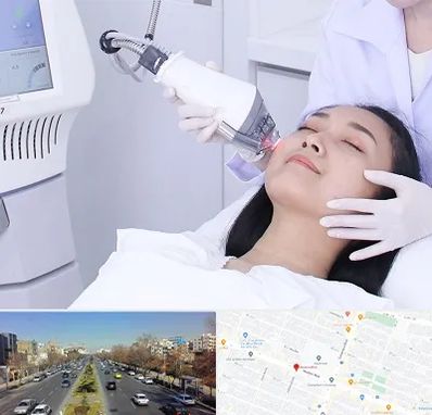 وایتنینگ در بلوار معلم مشهد