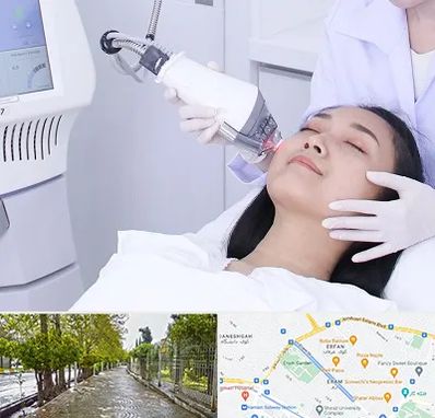 وایتنینگ در خیابان ارم شیراز