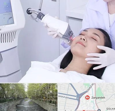 وایتنینگ در زرگنده