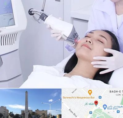 وایتنینگ در فلکه گاز شیراز