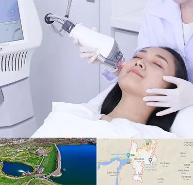 وایتنینگ در مهاباد