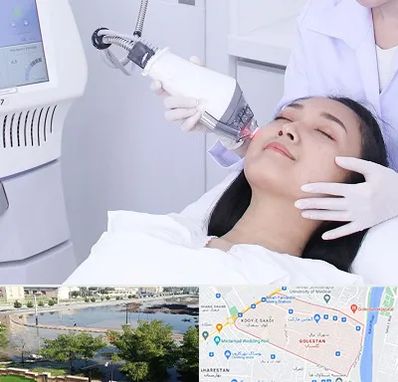 وایتنینگ در گلستان اهواز