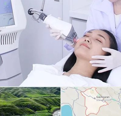 وایتنینگ در گچساران