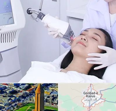 وایتنینگ در گنبد کاووس