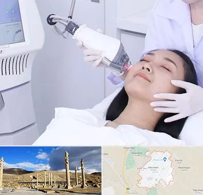 وایتنینگ در مرودشت