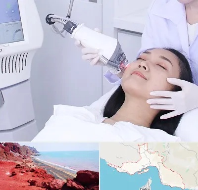 وایتنینگ در هرمزگان