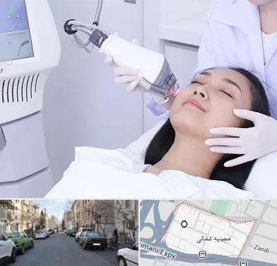 وایتنینگ در مجیدیه شمالی