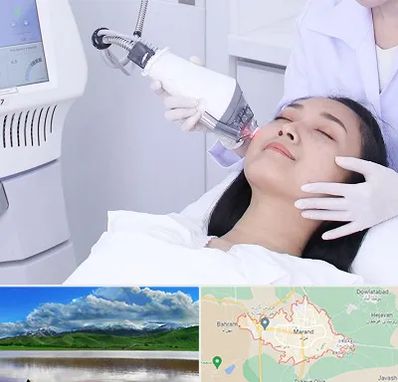 وایتنینگ در مرند